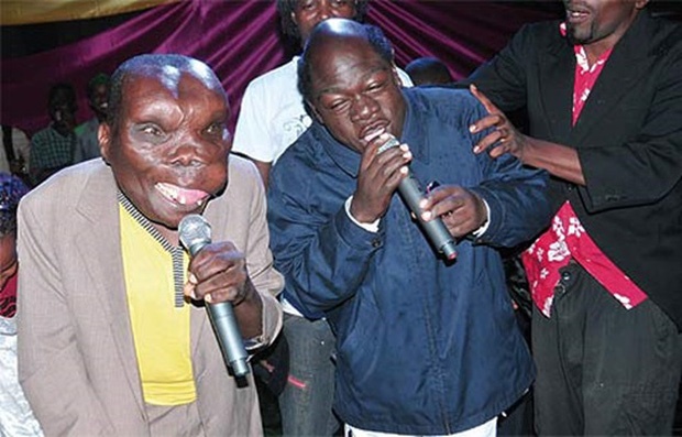 người đàn ông xấu xí nhất thế giới ảnh 2 nguoi dan ong xau xi nhat the gioi anh 2