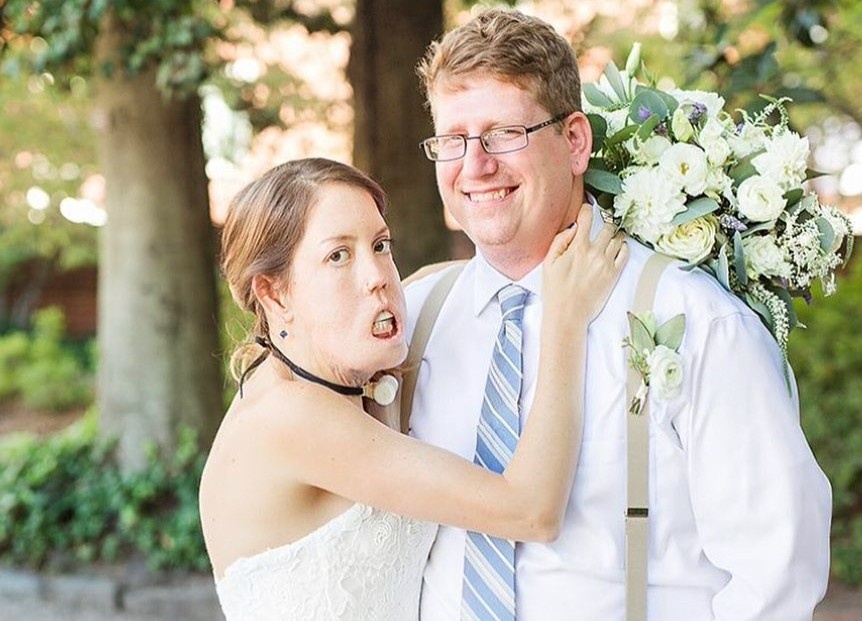 Co gai My mac benh la, khong the khep mieng hinh anh