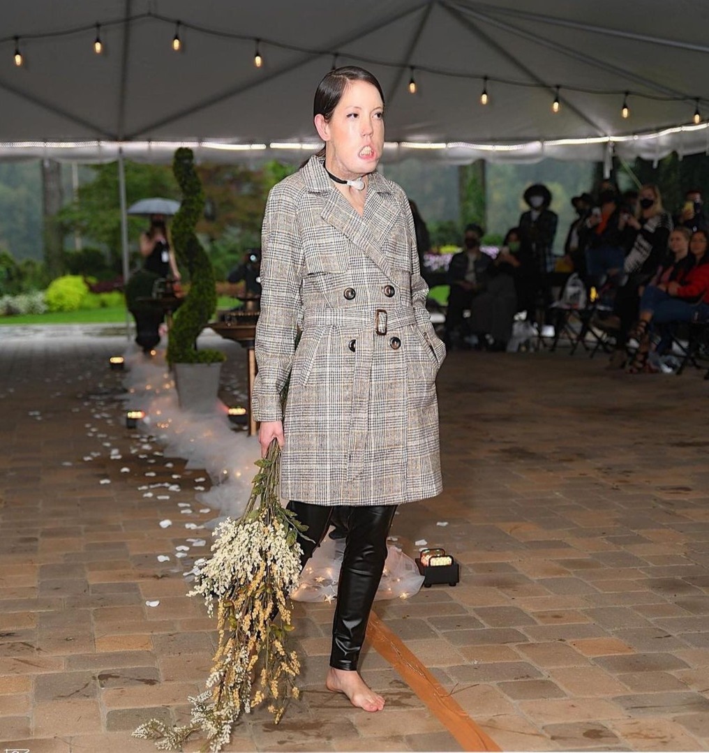 co gai khong the cuoi lam nguoi mau anh 3