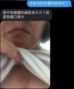 kien nguoi hoi suc tim phoi anh 1