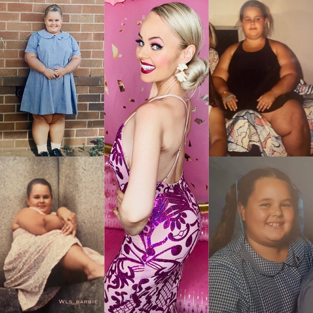 giam can de giong bup be anh 1