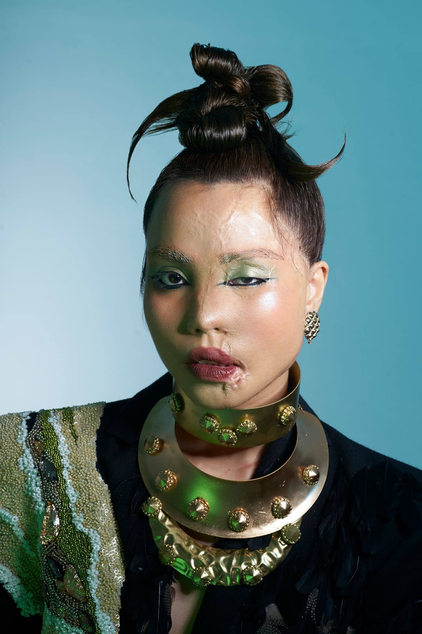 co gai bi chong sap cuoi tat axit anh 3