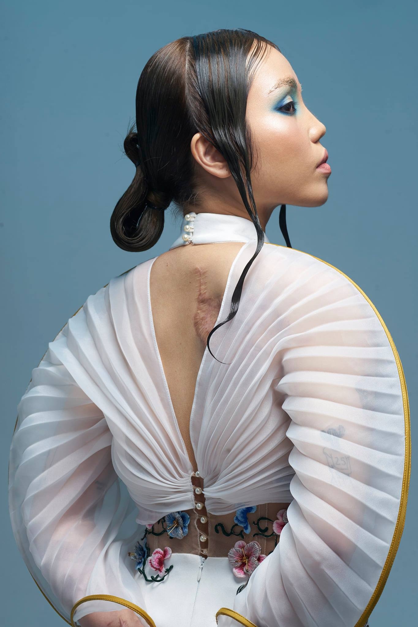 co gai bi chong sap cuoi tat axit anh 2