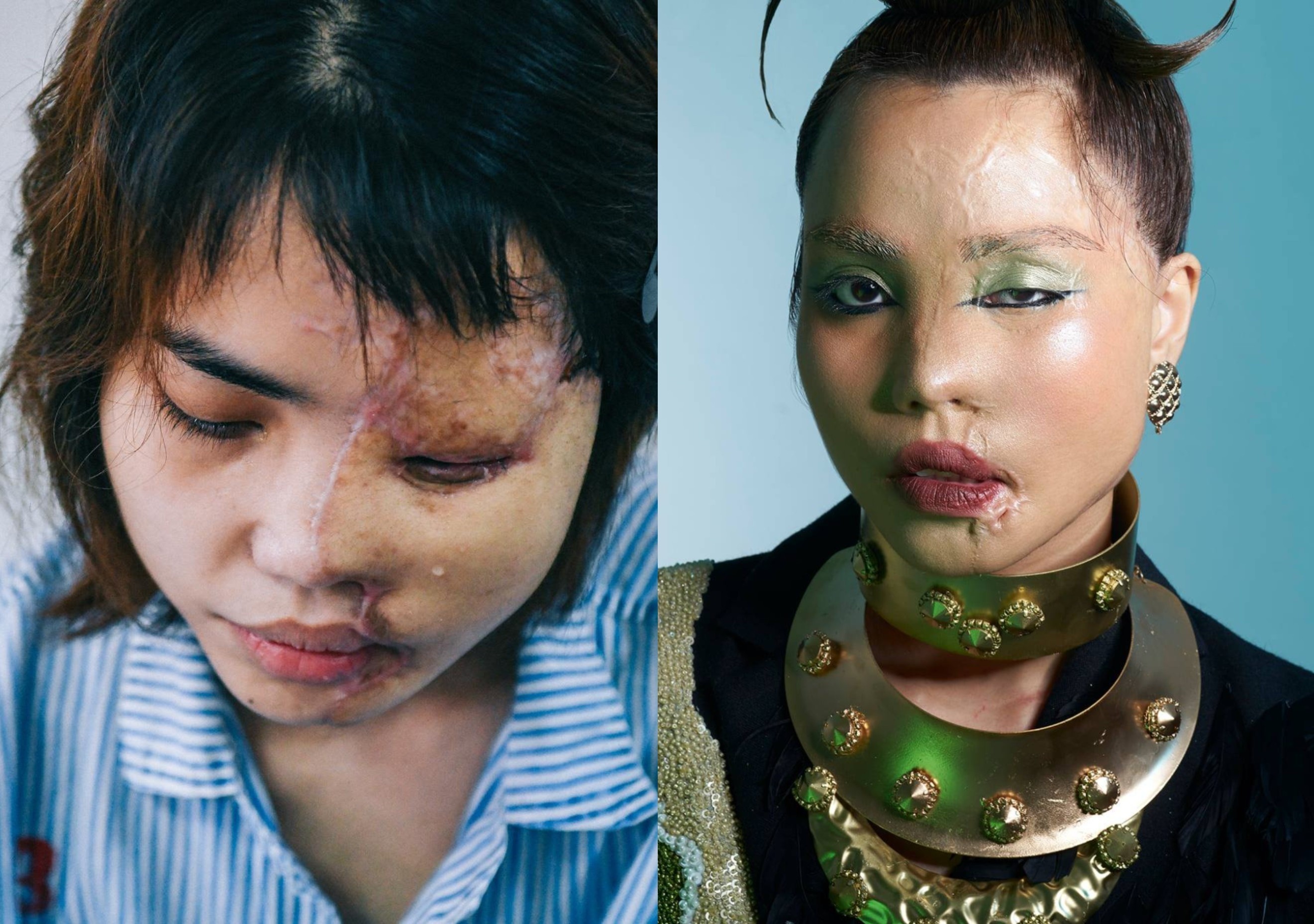 Co gai bi tat axit xuat hien trong bo anh nghe thuat hinh anh