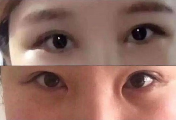 cat mi mat hong anh 4