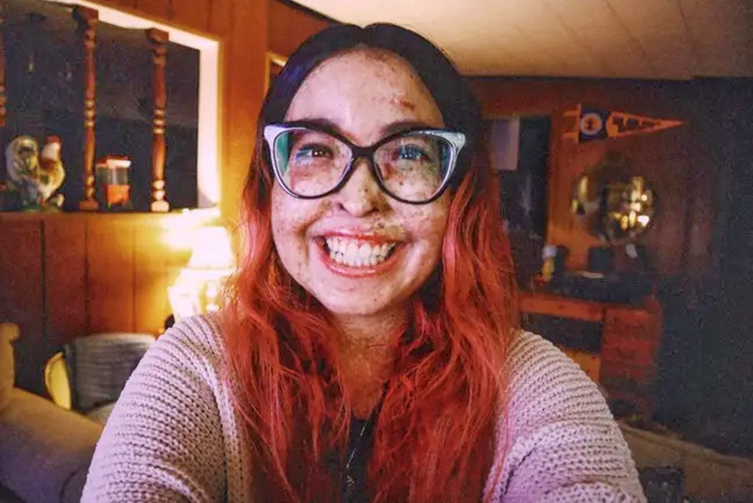 co gai di ung anh mat troi anh 2