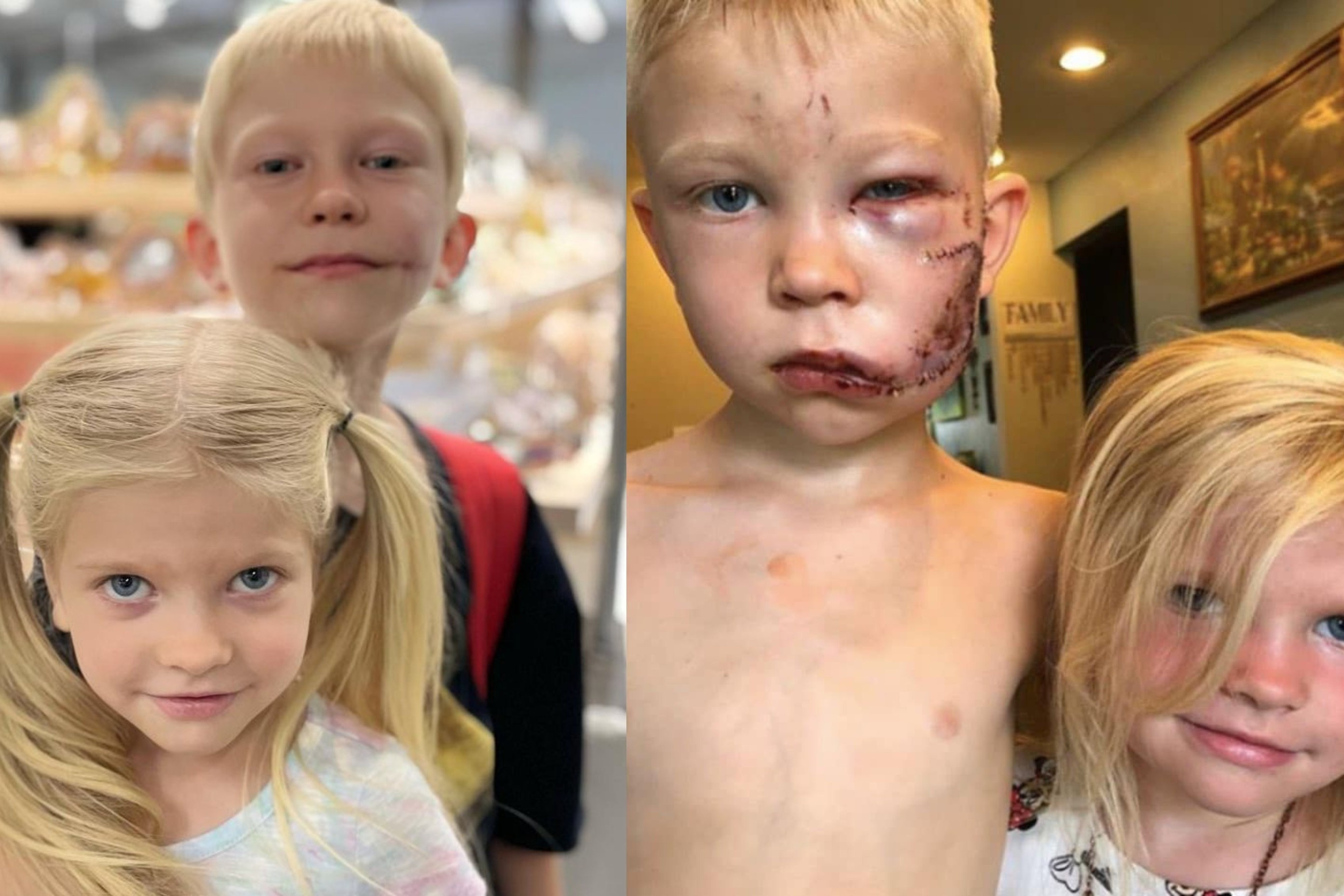 Cau be binh phuc sau khi cuu em gai khoi cho du hinh anh