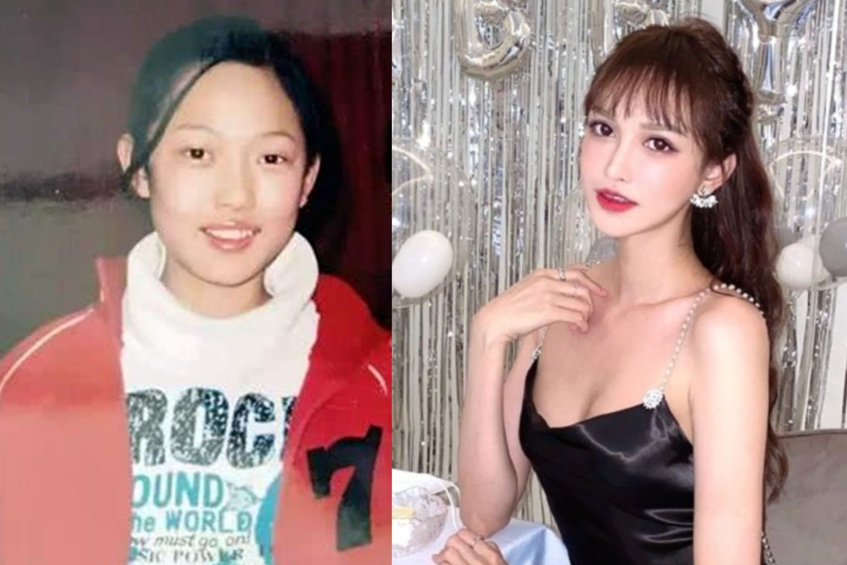 Trung Quoc siet quang cao phau thuat tham my hinh anh