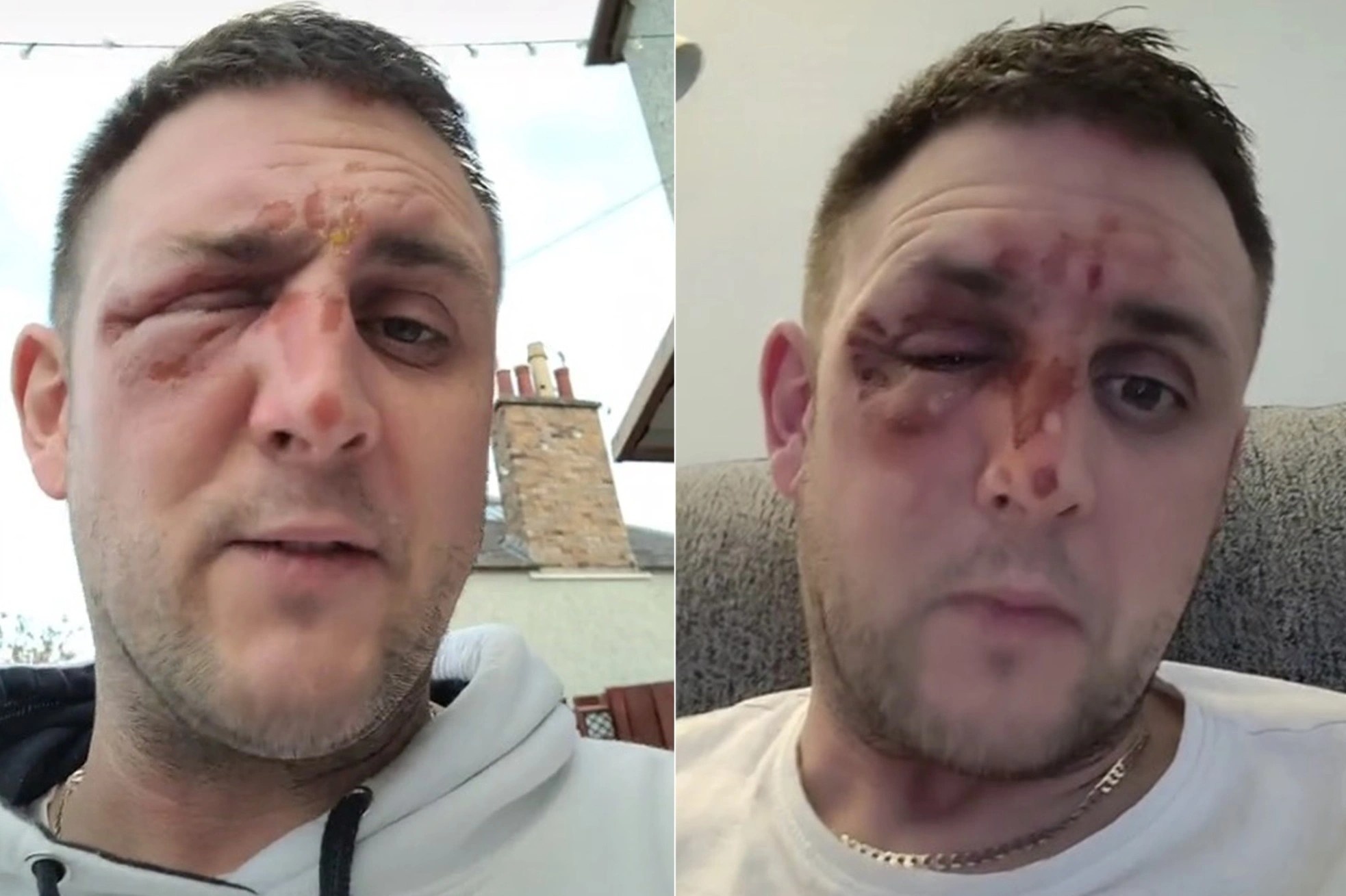 Bong mat vi nau an theo huong dan cua TikTok hinh anh