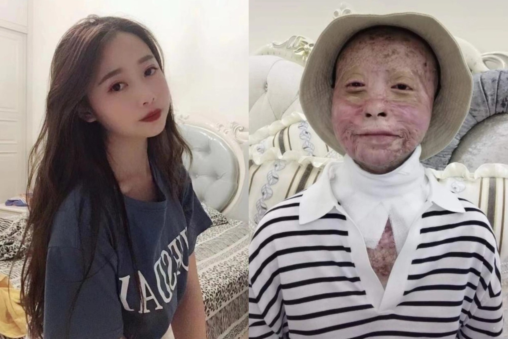 Nghi luc song cua co gai Trung Quoc sau tai nan xe hoi hinh anh