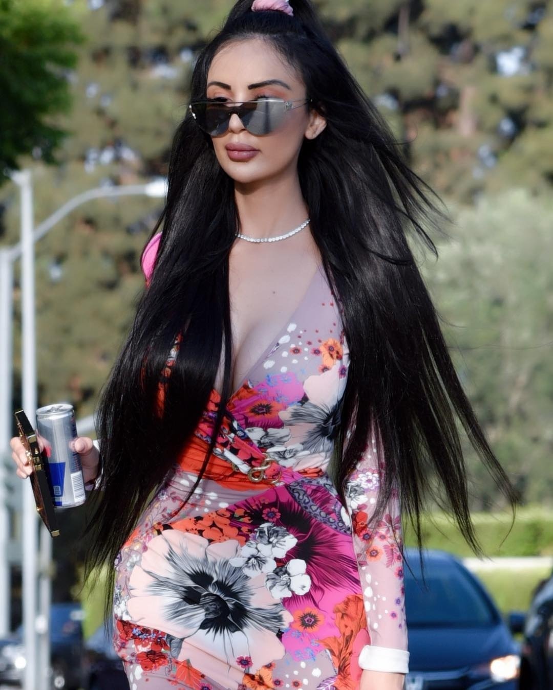 phẫu thuật giống Kim Kardashian ảnh 1 phau thuat giong Kim Kardashian anh 1