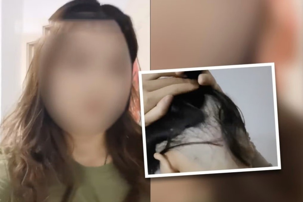 Bi lua cao nua dau khi di cat toc o Trung Quoc hinh anh