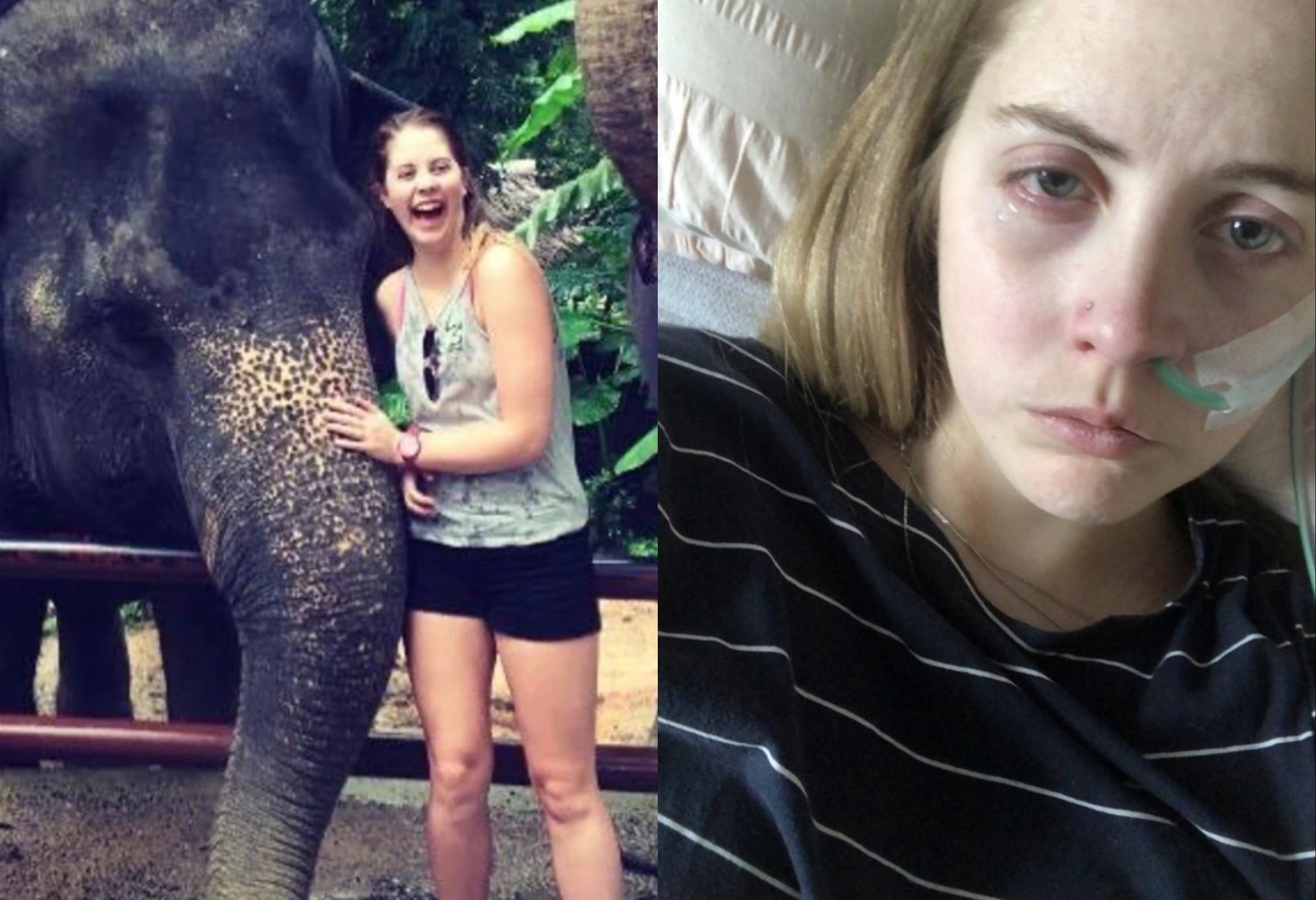 Dao lon cuoc song vi mac benh hiem gap sau chuyen du lich hinh anh