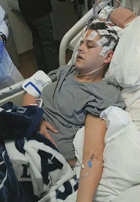 phau thuat giam beo anh 2