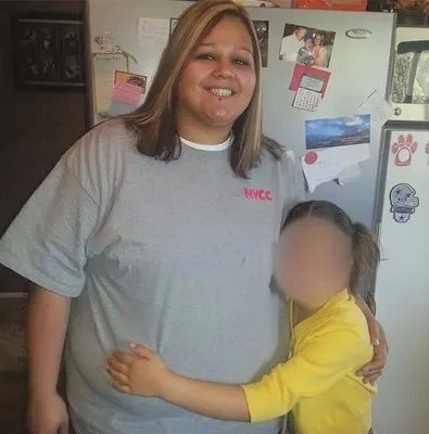 phau thuat giam beo anh 1