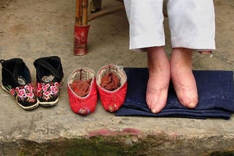 Doi giay bi len an o Trung Quoc hinh anh