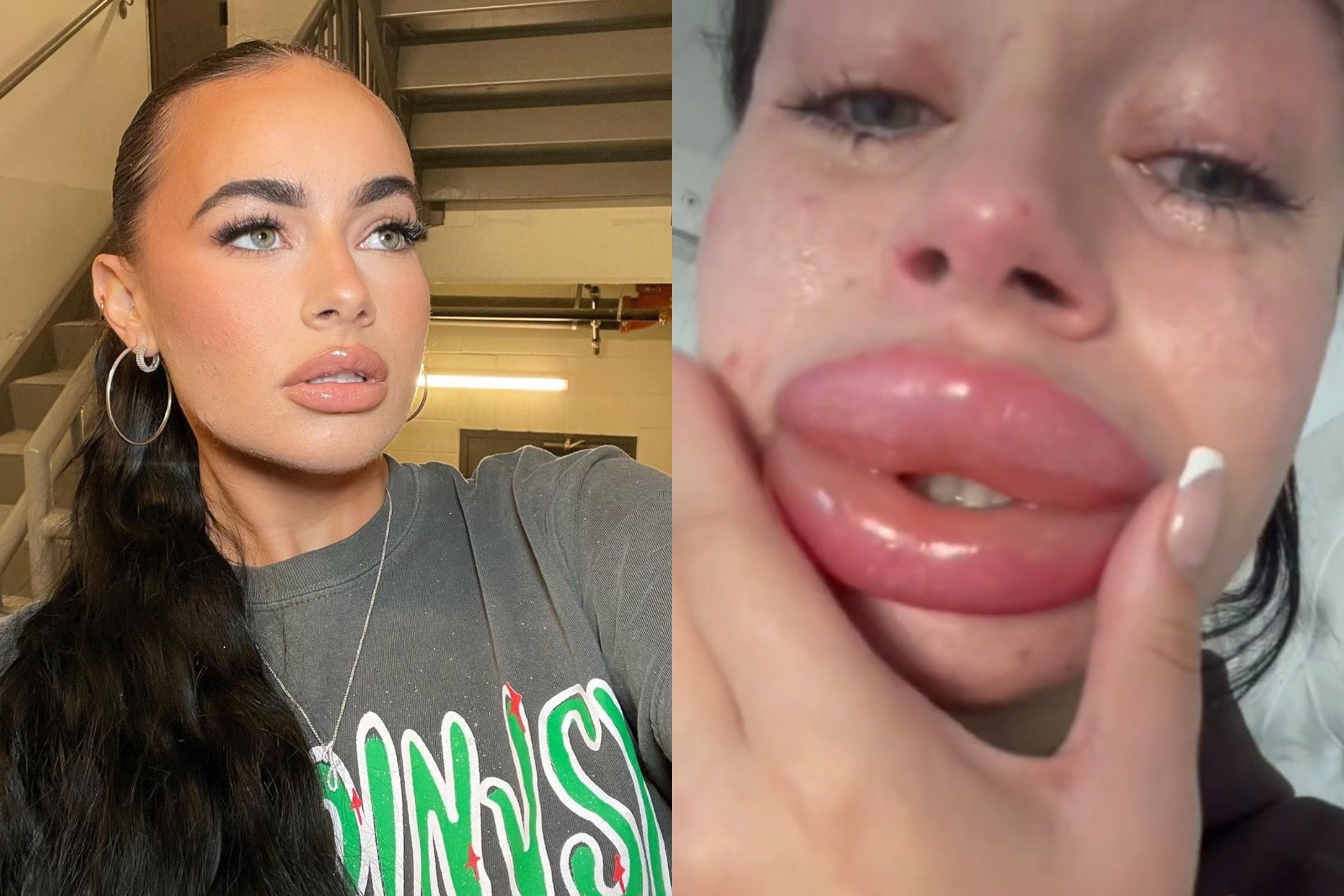 Hoi han vi tiem moi mien phi hinh anh