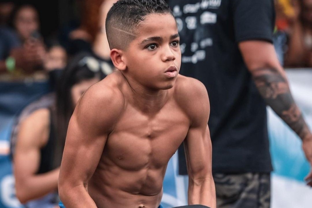 Co bung 6 mui cua cau be 12 tuoi hinh anh