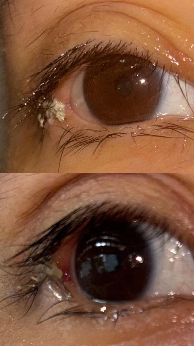 ngo doc khi formaldehyde anh 3