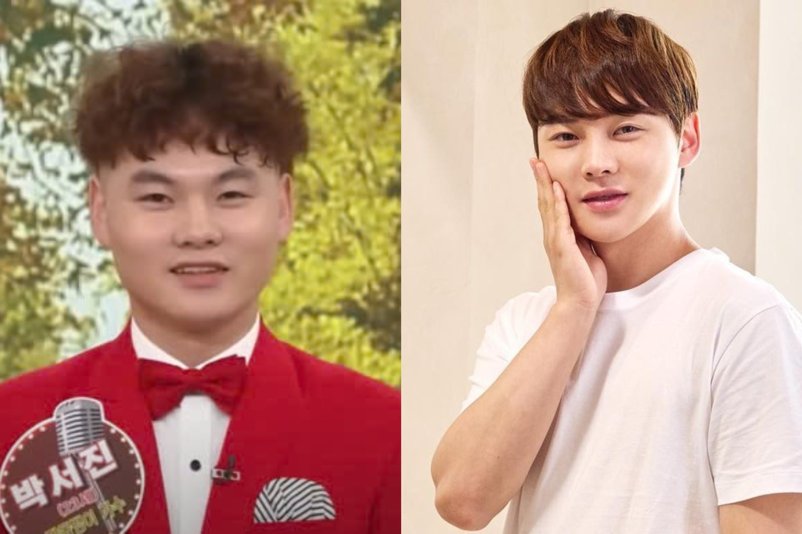 Guong mat cua chang trai Han chi 100 trieu won phau thuat tham my hinh anh