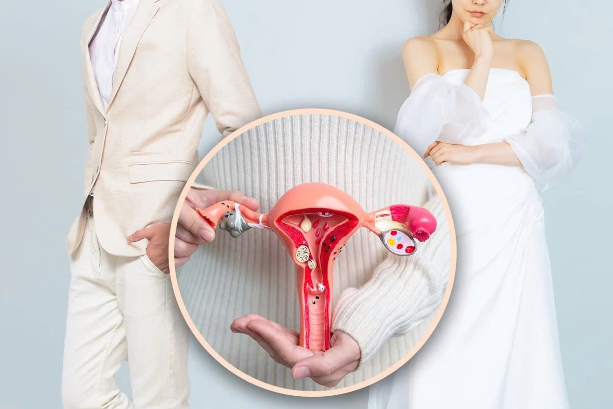 Chong doi huy ket hon vi vo giau chuyen mac benh tam than, cat tu cung hinh anh