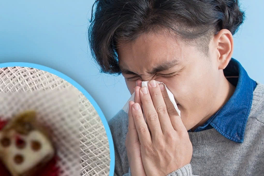 Thanh nien bi ket con xuc xac trong mui suot 20 nam hinh anh