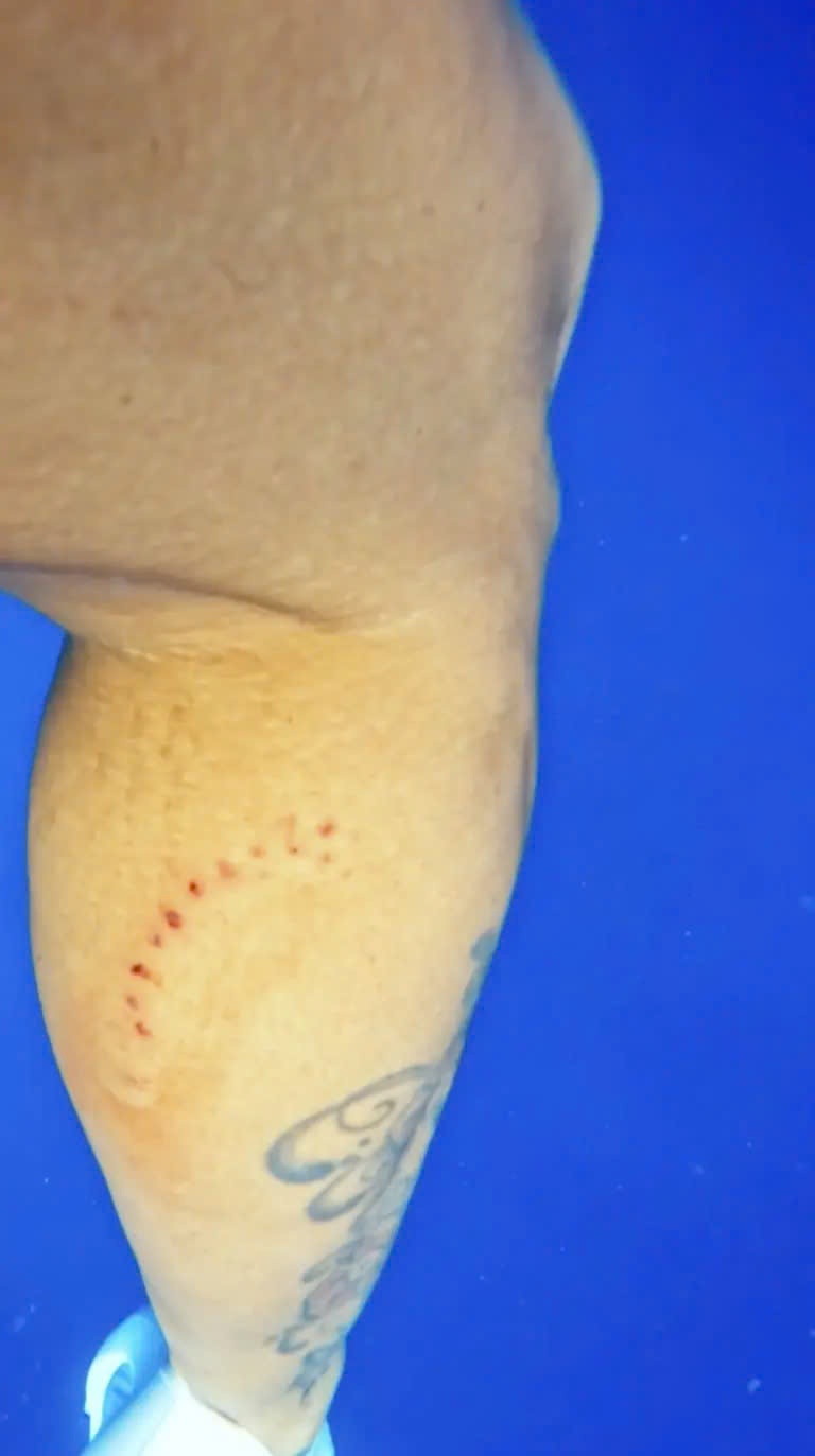 ca map mieng ban le anh 1