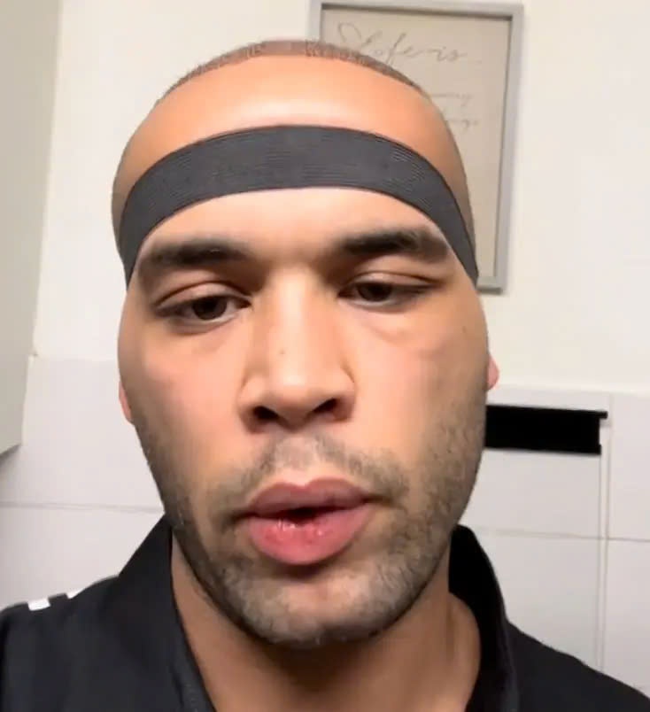 dau sung do cay toc anh 1