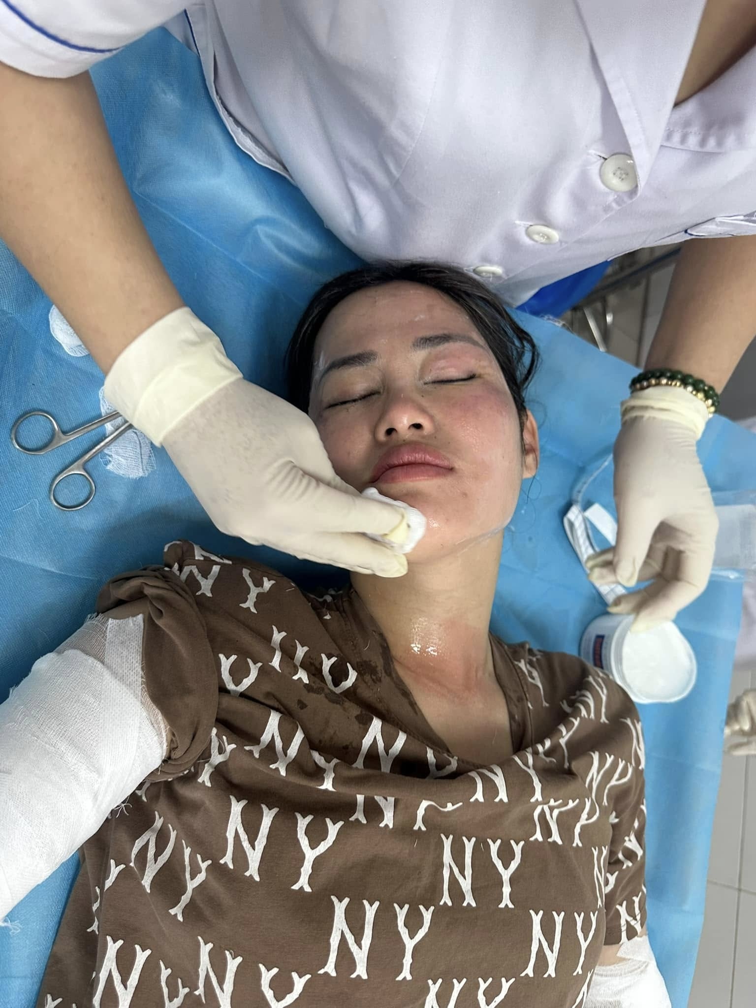 bong do no bong bay anh 1