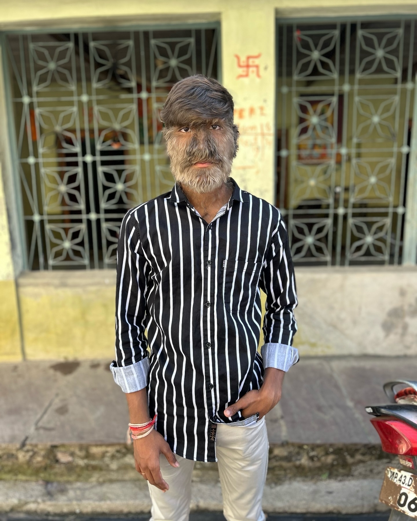 mac hoi chung nguoi soi anh 1