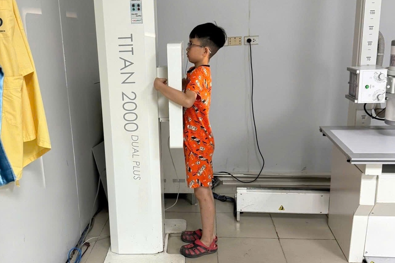 Trai he 'ac mong' hinh anh