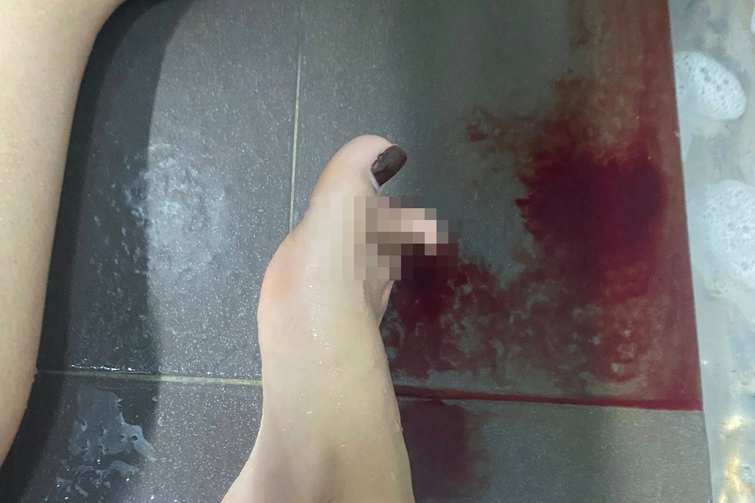 Khach nu truot nga gay gap ngon chan o phong tam be boi Ha Noi hinh anh