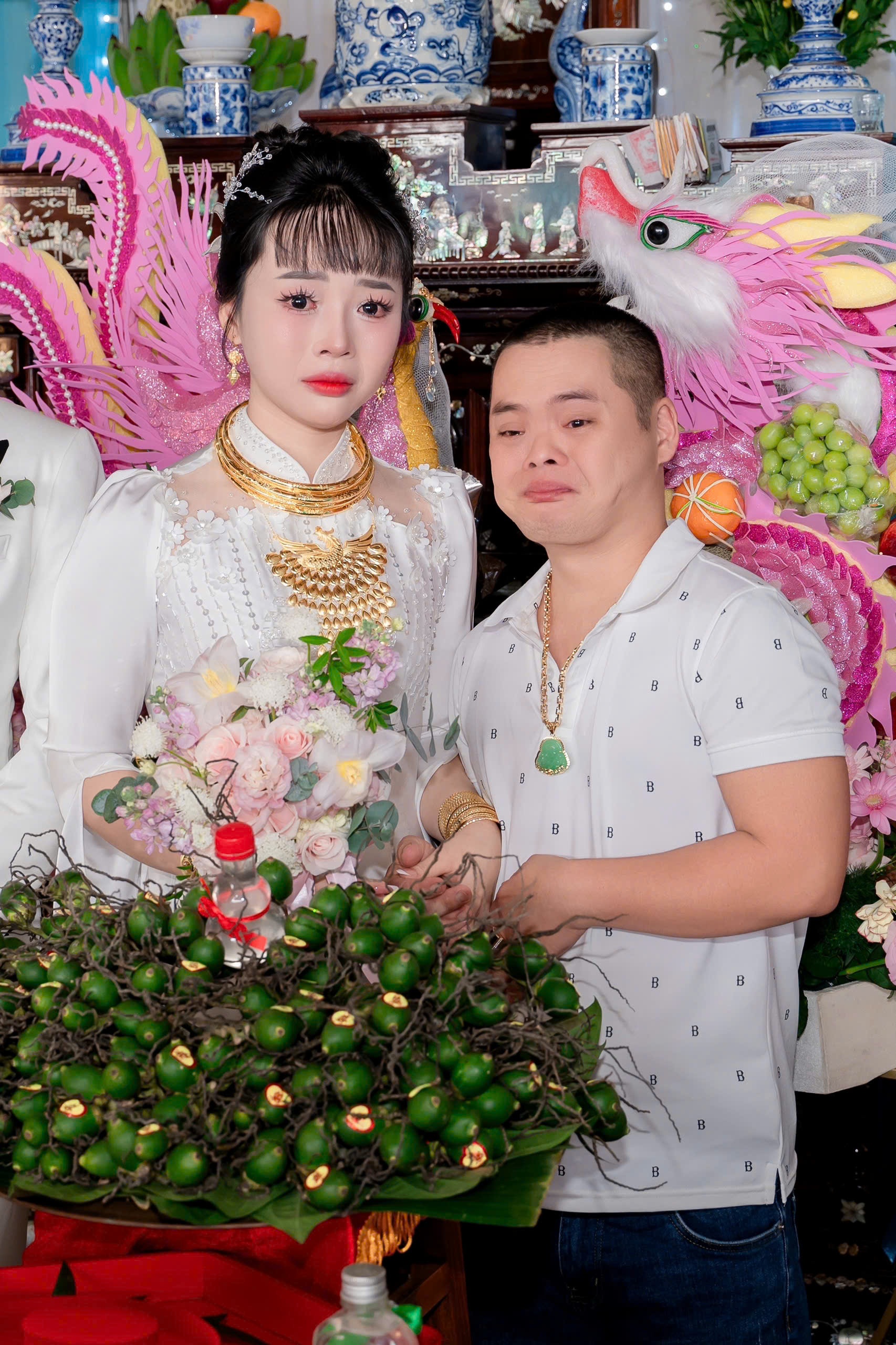 anh trai benh down anh 1