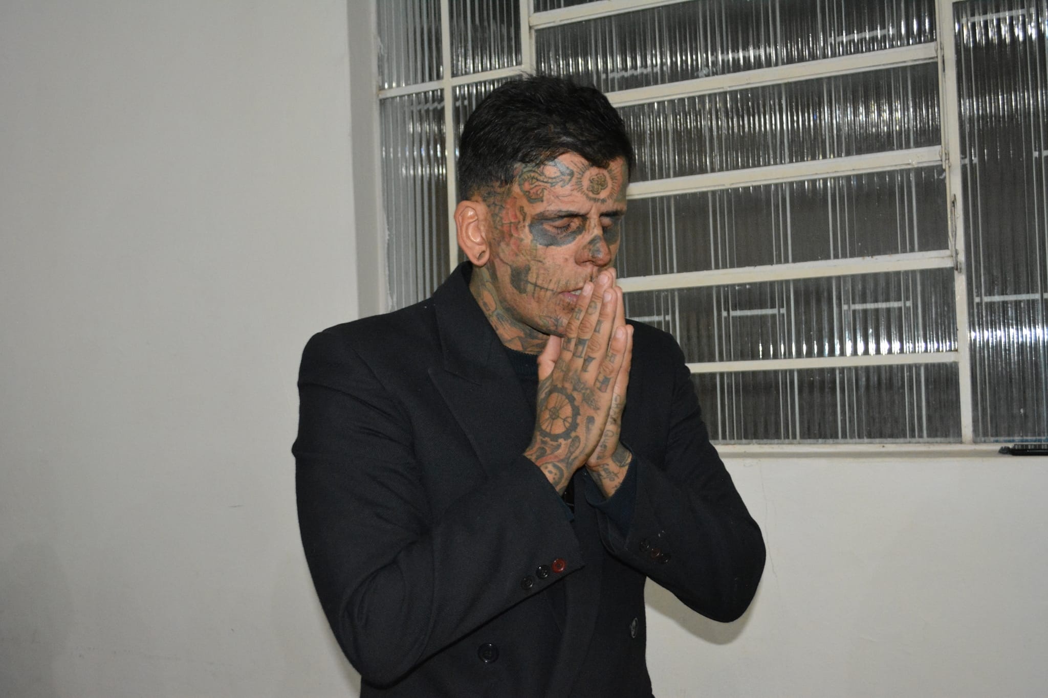 xóa xăm kín thân ảnh 4 xoa xam kin than anh 4