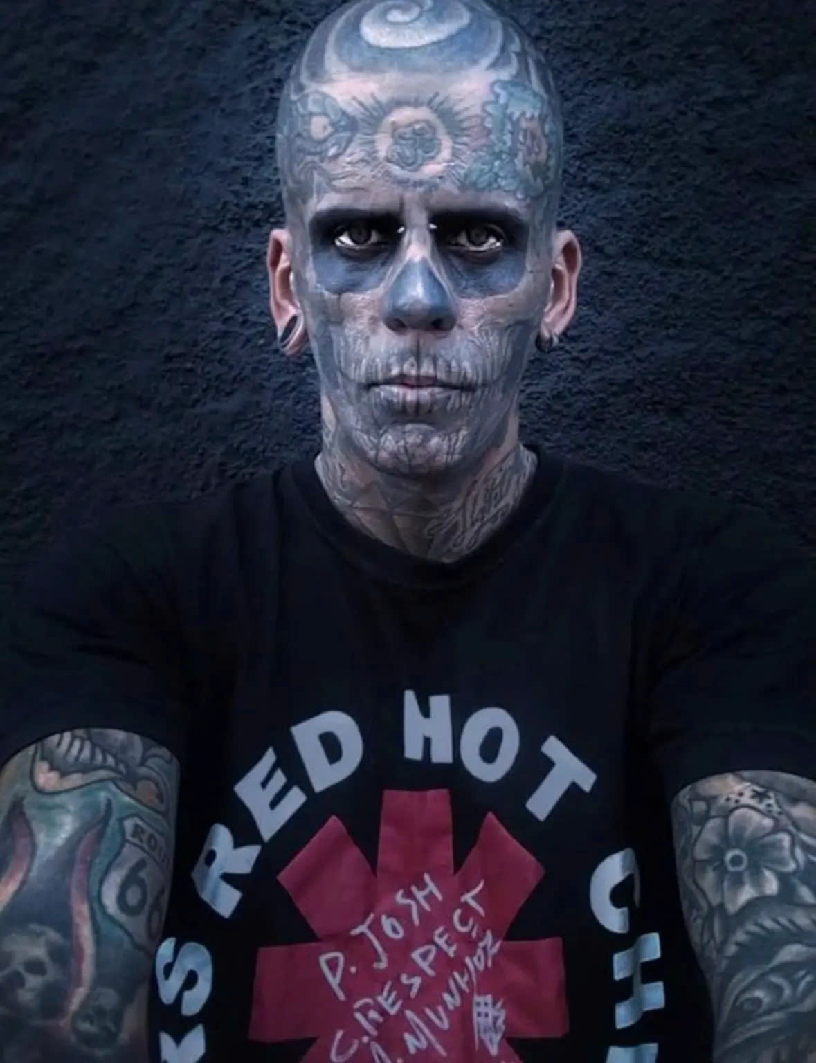 xóa xăm kín thân ảnh 2 xoa xam kin than anh 2