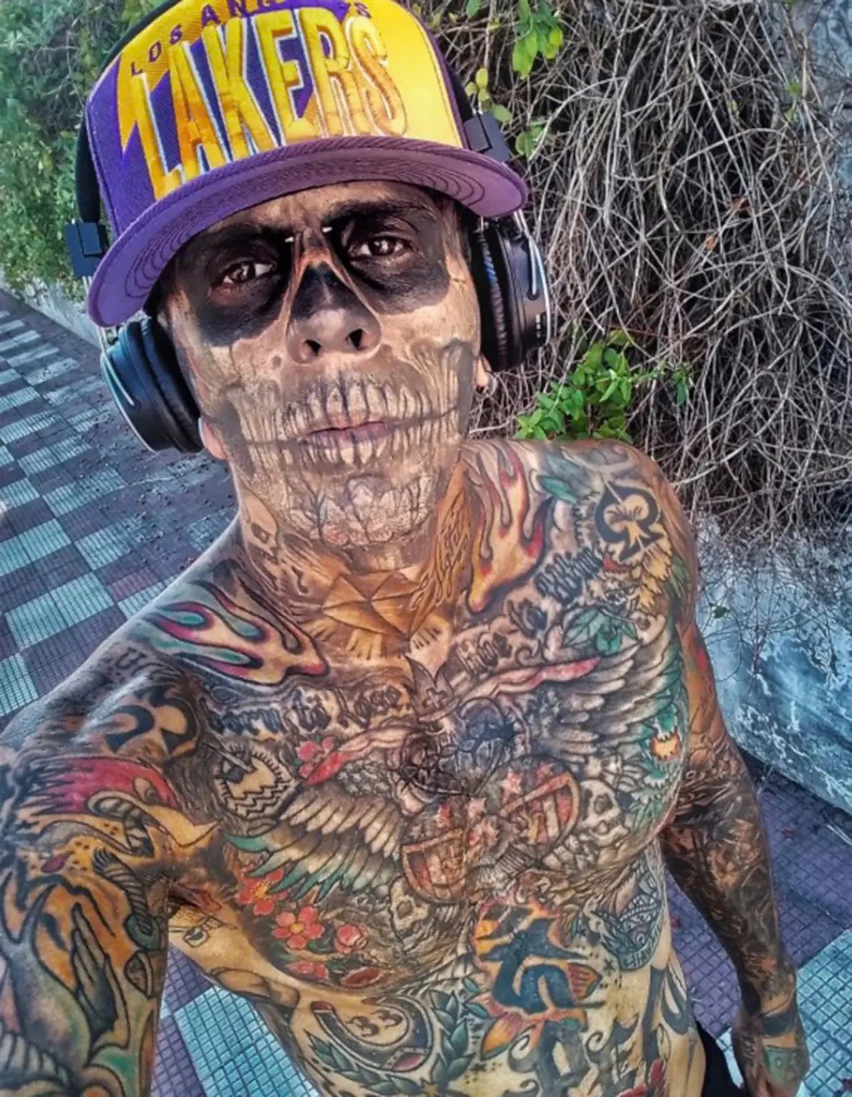 xóa xăm kín thân ảnh 3 xoa xam kin than anh 3