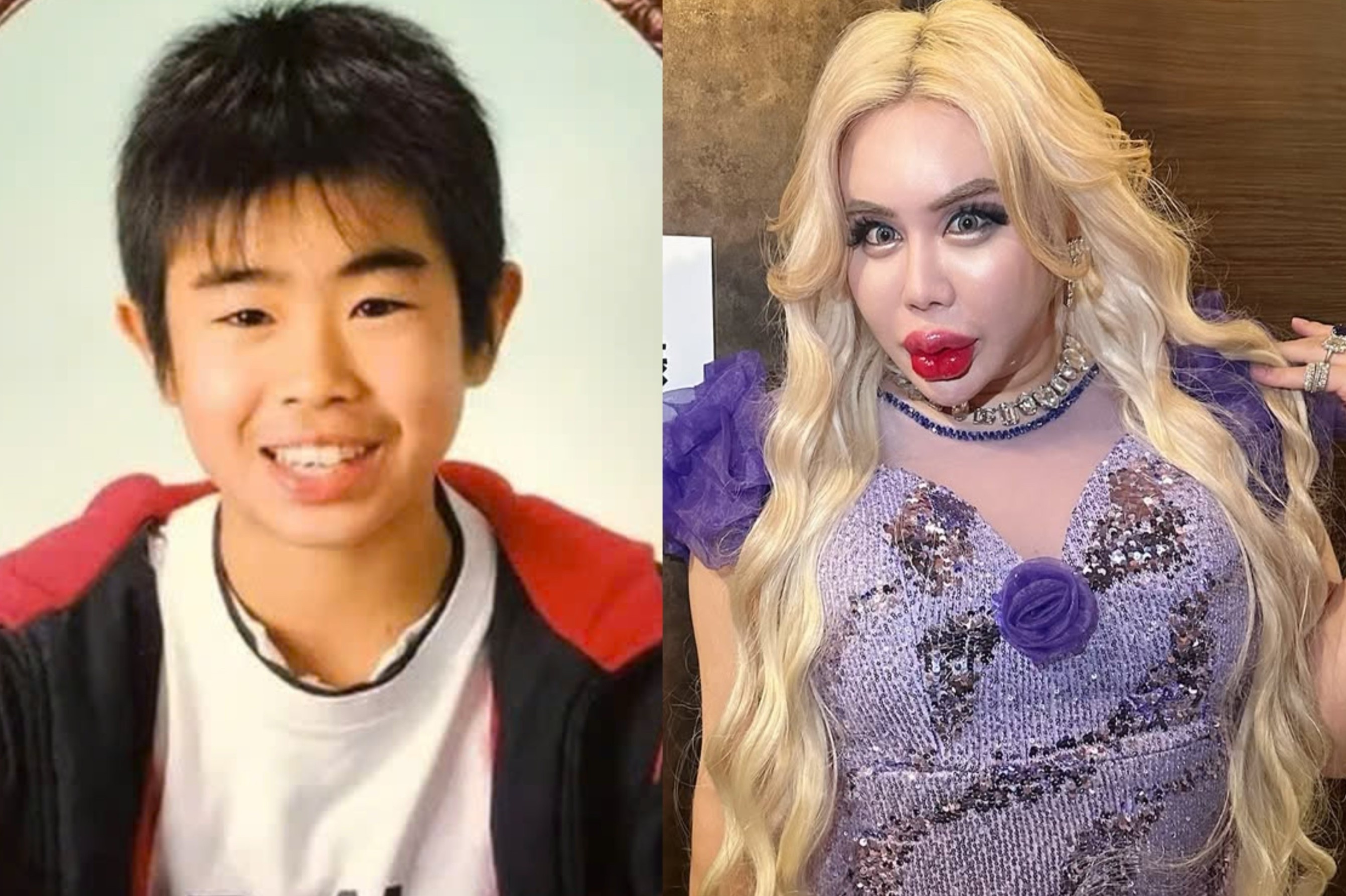 Dao keo hon 200 lan de thanh 'nguoi dep nhat the gioi' hinh anh