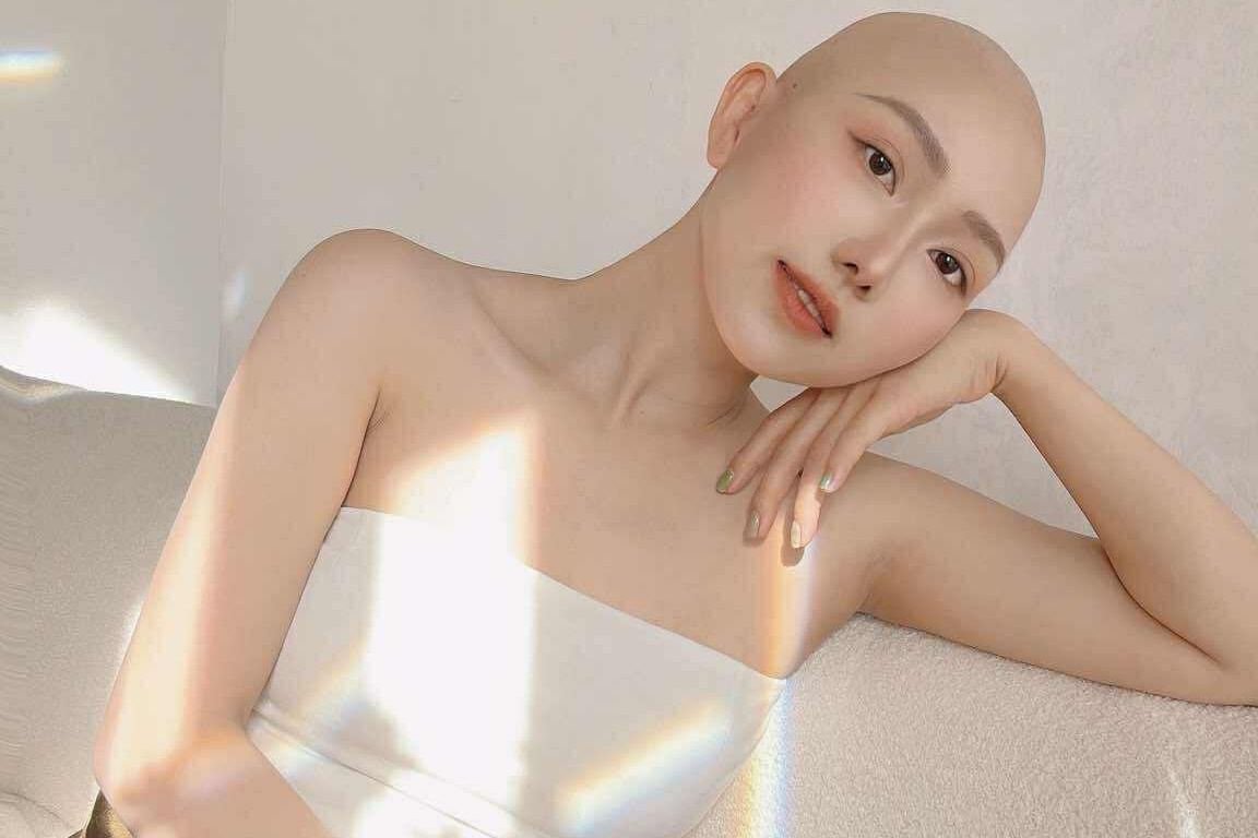 Buc anh cua co gai TP.HCM mac ung thu o tuoi 28 viral khap MXH hinh anh