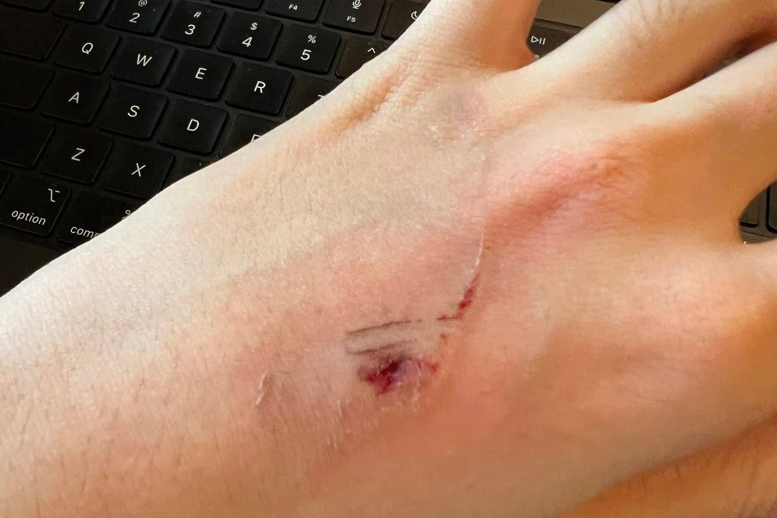 Ngoi ca phe o TP.HCM, co gai bi van go roi trung dau, hong laptop hinh anh