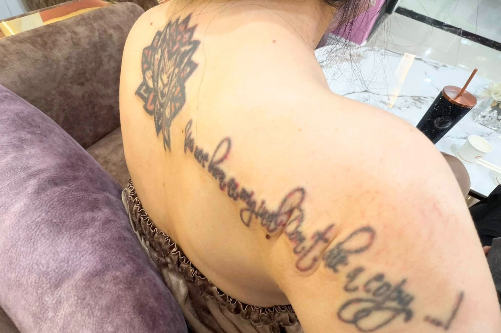 TikToker Vo Ha Linh chi 45 trieu dong cho 11 lan xoa xam hinh anh