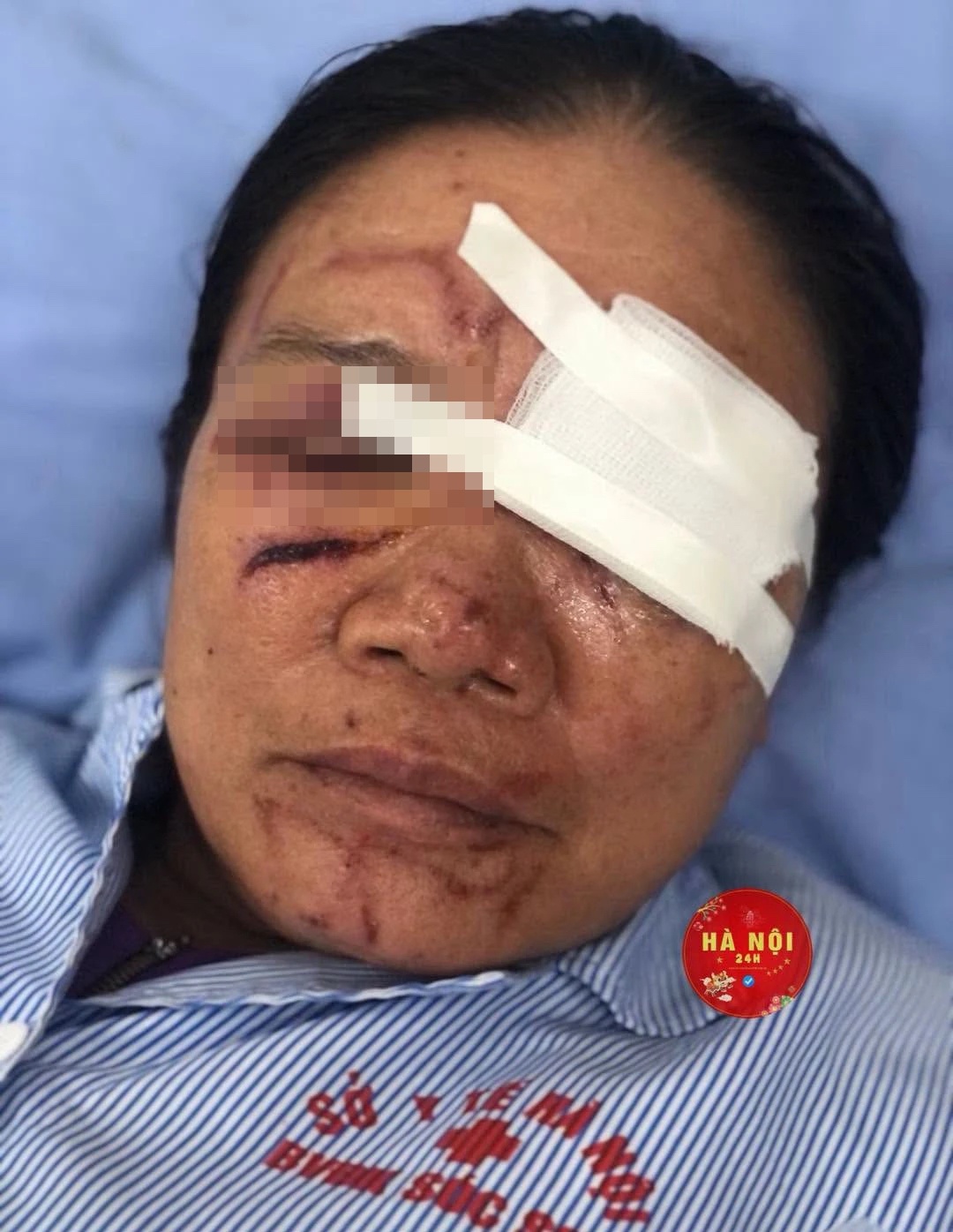 xit nuoc anh 1