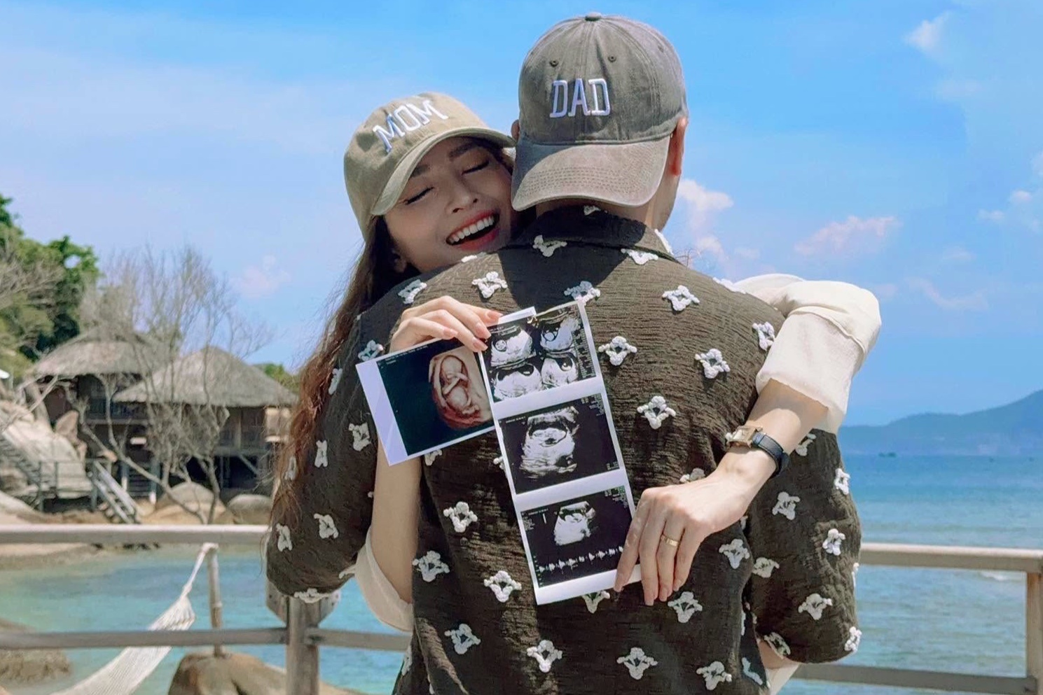 Vo Duc Huy mang thai con dau long hinh anh