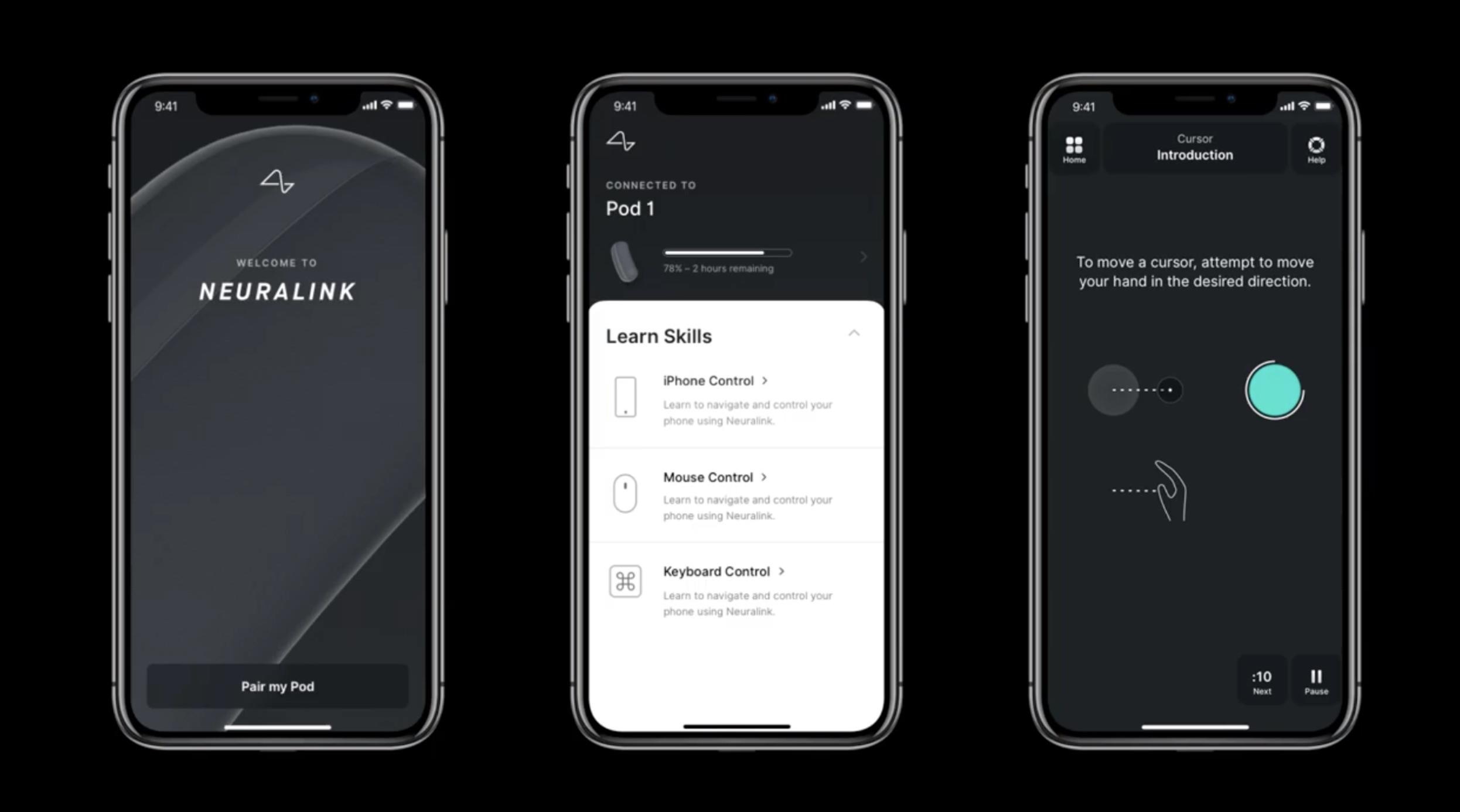 chip doc nao nguoi cua neuralink anh 4
