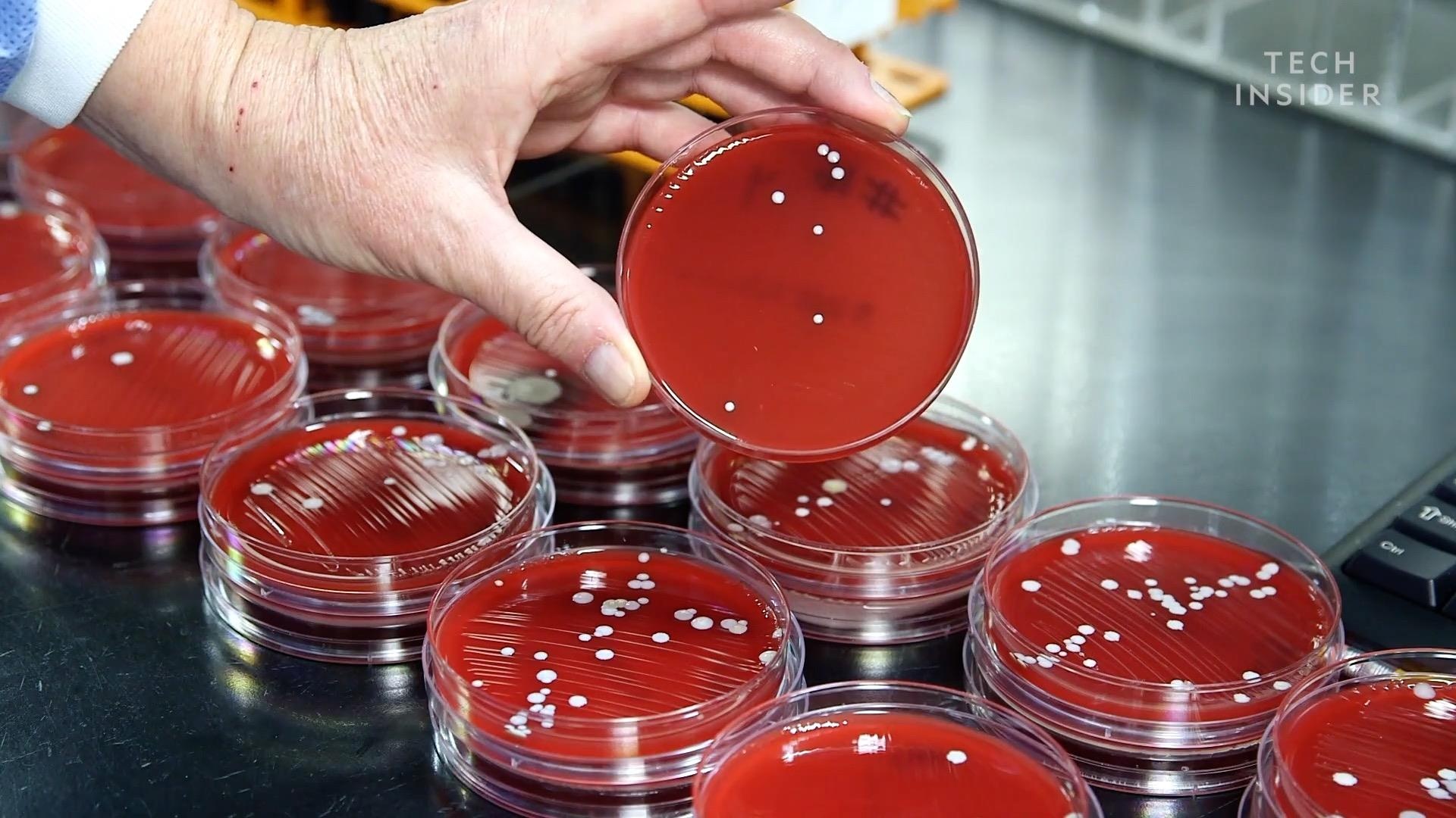 vì sao bạn không nên chia sẻ tai nghe với người khác ảnh 2 vi sao ban khong nen chia se tai nghe voi nguoi khac anh 2