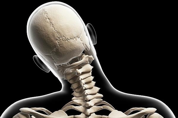 Chan thuong dau, co tang manh ke tu khi iPhone xuat hien hinh anh