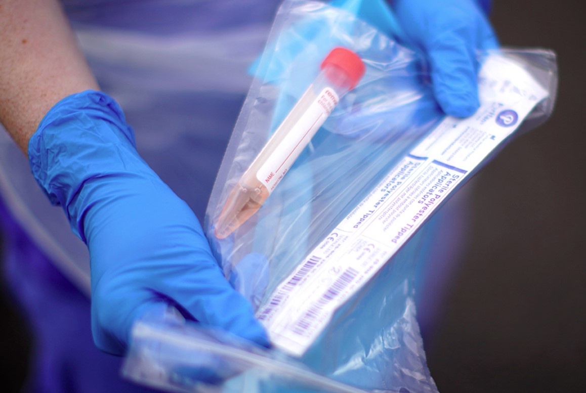 bo xet nghiem nhanh covid-19 anh 2