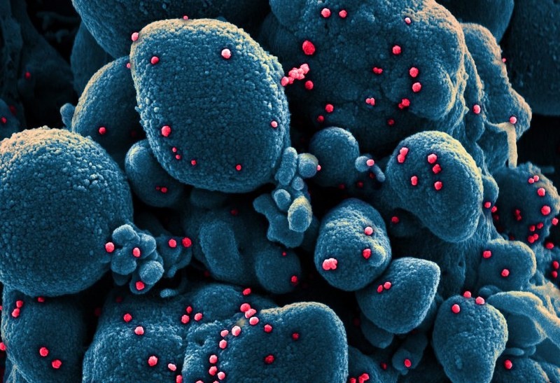 Hinh anh virus nCoV tung buoc bam va giet te bao duoi kinh hien vi hinh anh