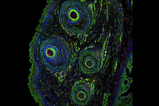 ben trong sinh vat bat tu co gi anh 4