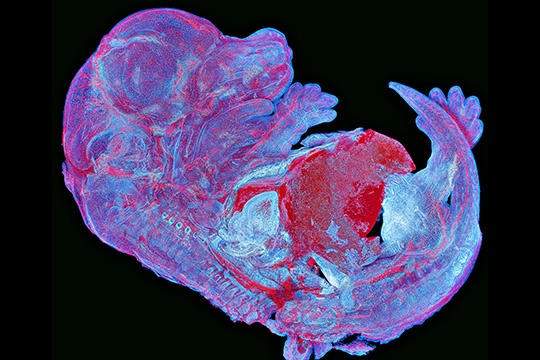 ben trong sinh vat bat tu co gi anh 5