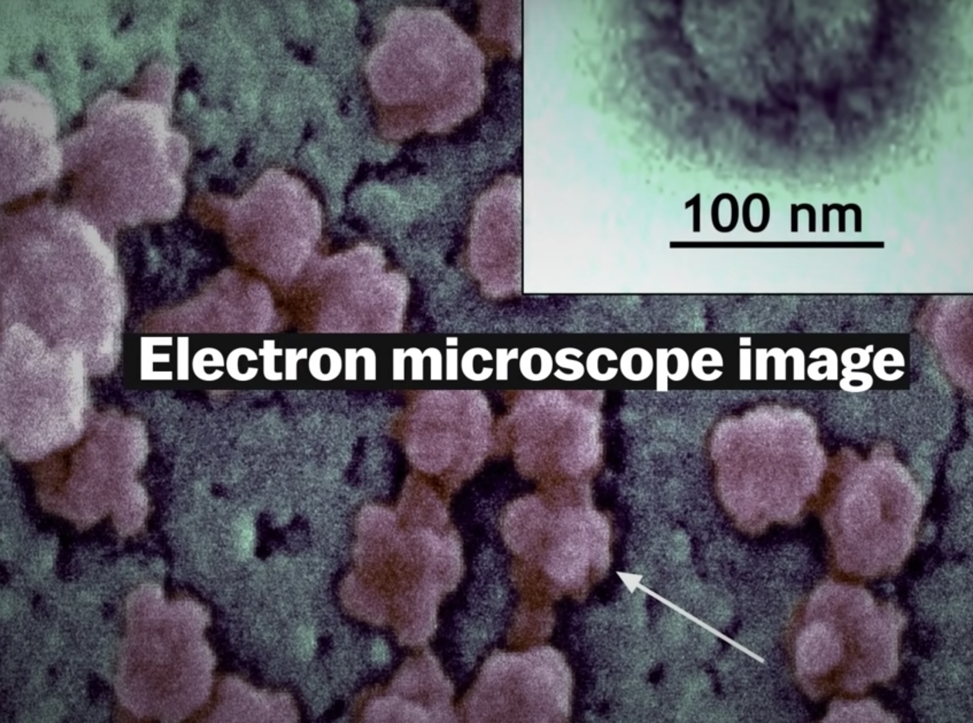 lam sao chup duoc virus SARS-CoV-2 anh 3